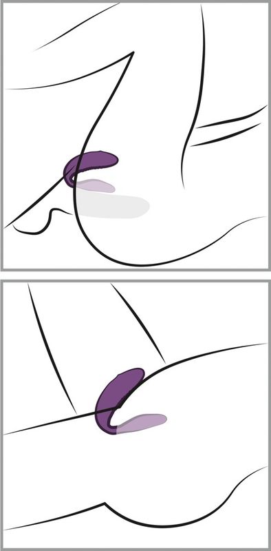 We-vibe - Chorus Lilla
